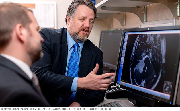 Acoustic neuroma research at Mayo Clinic
